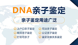 舟山群岛新区如何偷偷做DNA鉴定，舟山群岛新区亲子鉴定详细流程